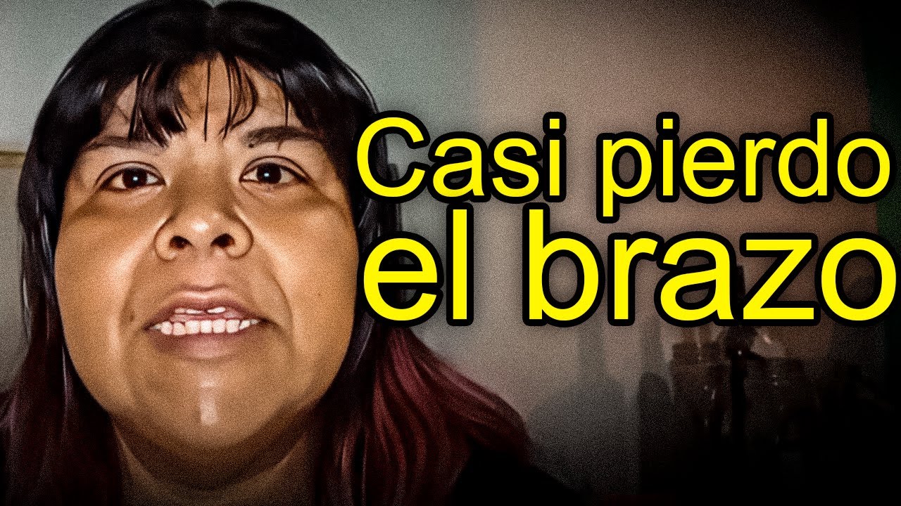 El NACIMIENTO del BEBE de AIMEP3 es PREOCUPANTE.