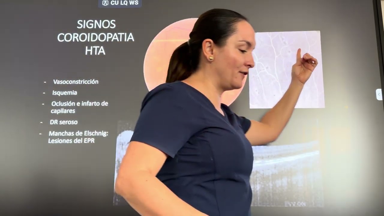 Retinopatía hipertensiva 