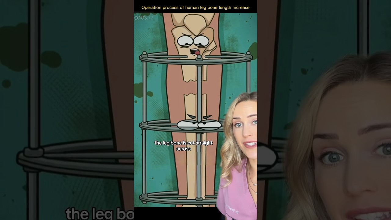 How this surgery makes you taller!