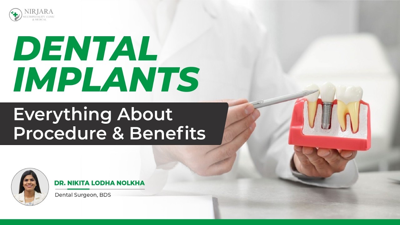 What Are Dental Implants | Procedure, Benefits & Recovery | Dr Nikita Lodha Nolkha