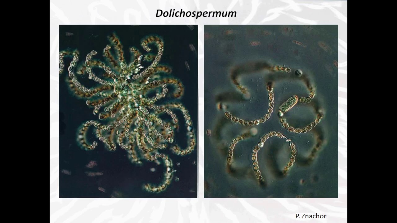Les cyanobactéries, microscopiques mais fondamentales !