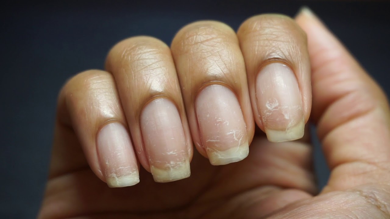 No Buffing or Soaking This Time 😧?? An Anti Damaged Nails + Bounce Back Routine 💅🏽💪🏽