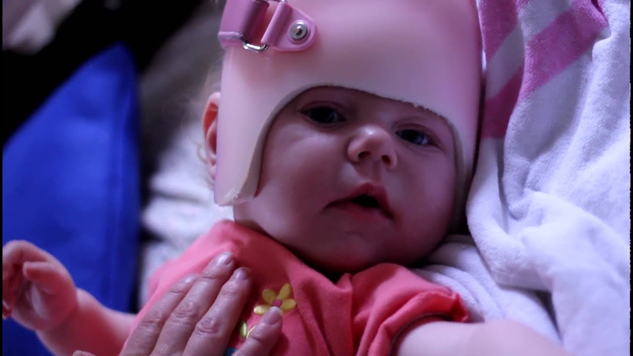 Peter Lively 2 - Ellie seizure - infantile spasm.mov