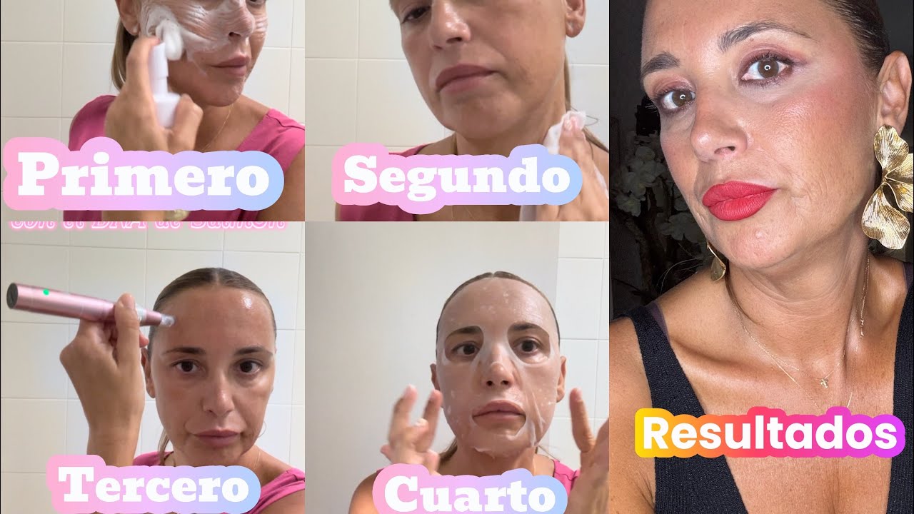 Dermapen Hidratación Profunda…Microneedling 😘🎀🌺