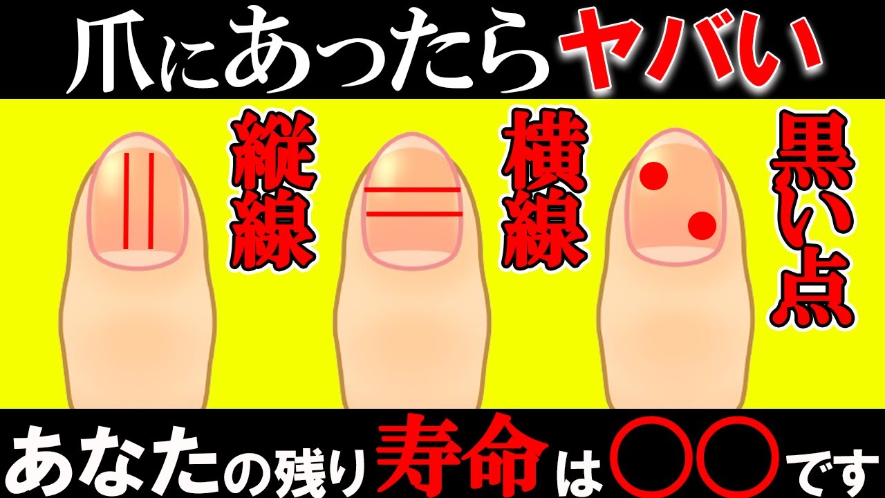 爪にあったらヤバい！？あなたの寿命が〇〇になっている？【ゆっくり解説】