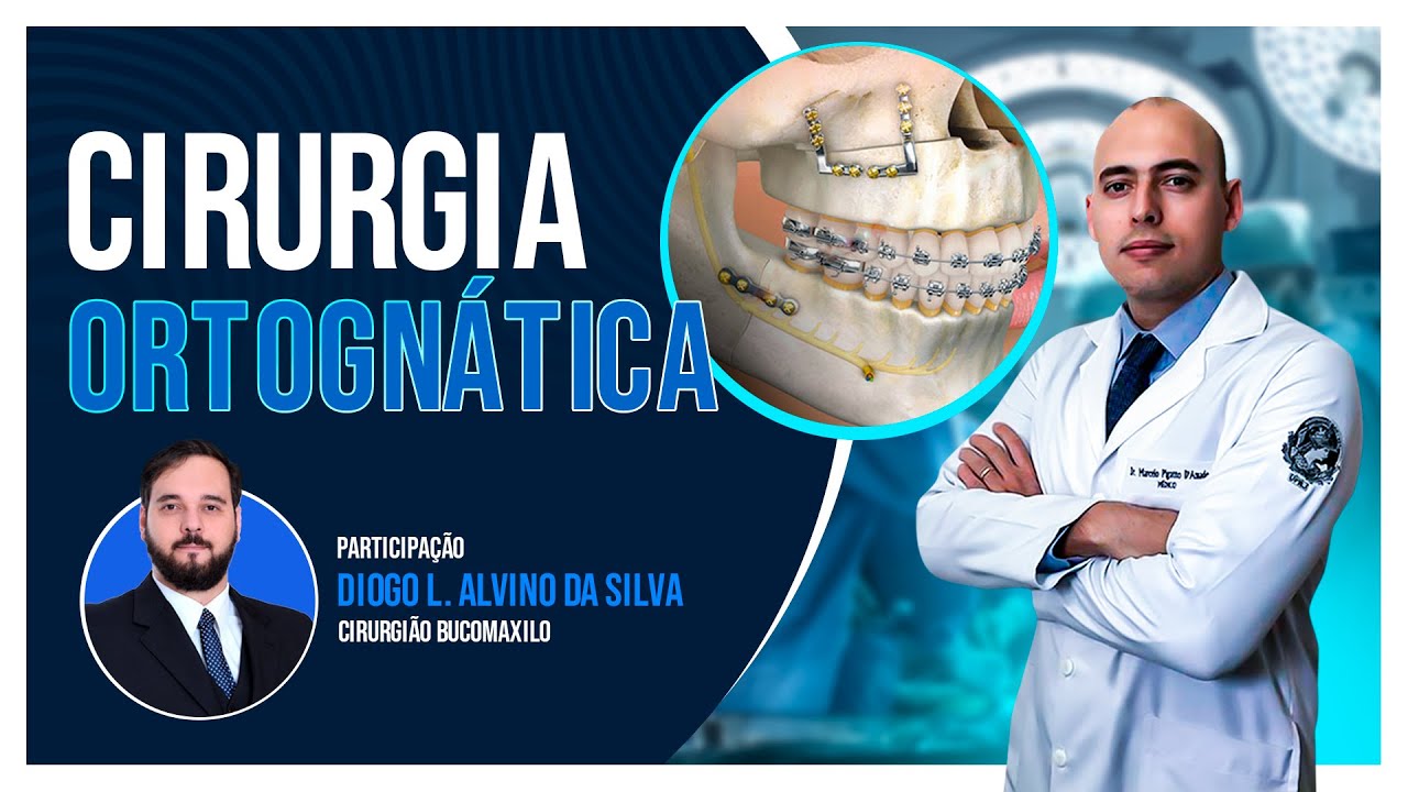 CIRURGIA ORTOGNÁTICA | VOCÊ SABE O QUE É?
