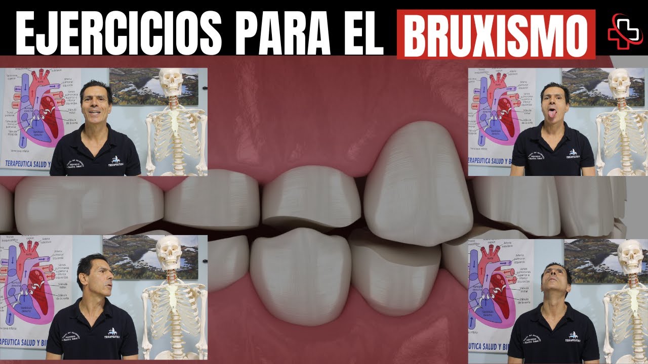Ejercicios para el bruxismo