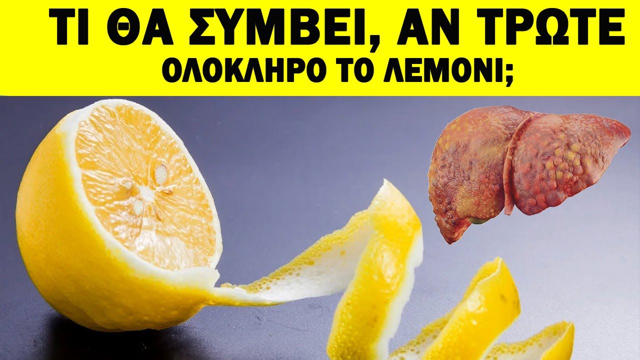 Γιατί Να Τρώτε Ολόκληρο Το Λεμόνι; Τα Οφέλη Που ΔΕΝ Γνωρίζατε! | Ακαδημία Υγείας