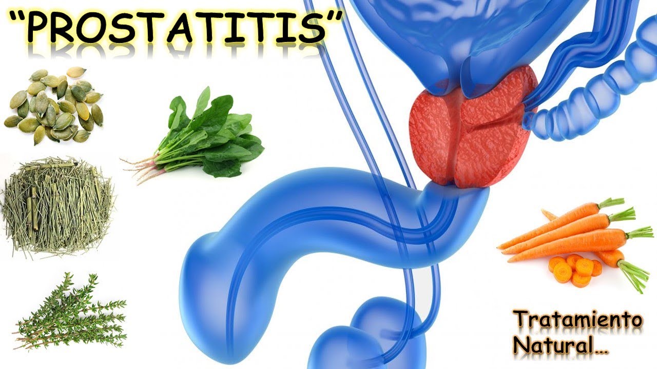 PROSTATITIS - TRATAMIENTO NATURAL -  REMEDIO CASERO | NutriCiencia