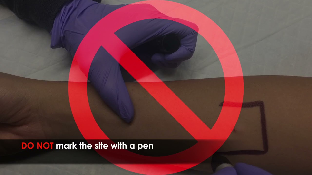 TUBERCULOSIS SKIN TEST TRAINING