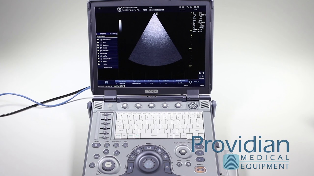 DICOM Setup on the GE Logiq e and GE Vivid e Ultrasounds