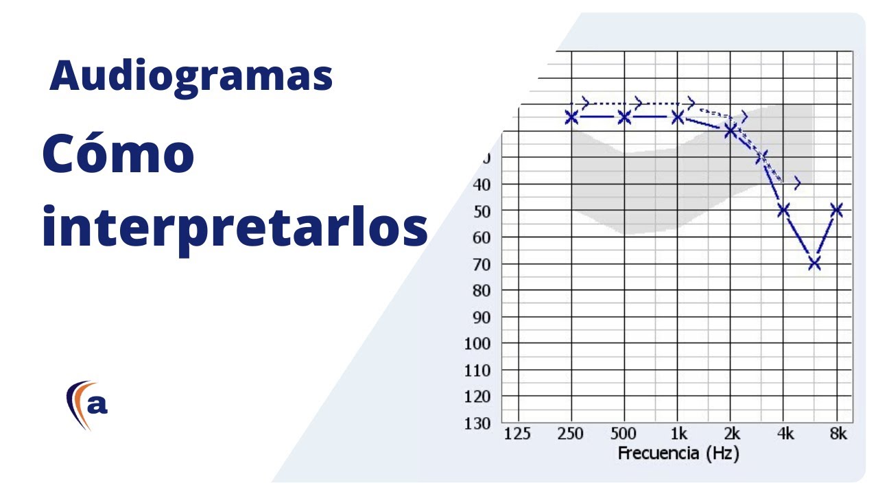 AUDIOGRAMA | Entiende el resultado de una audiometría tonal