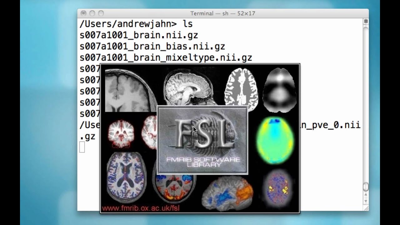 FSL's FAST