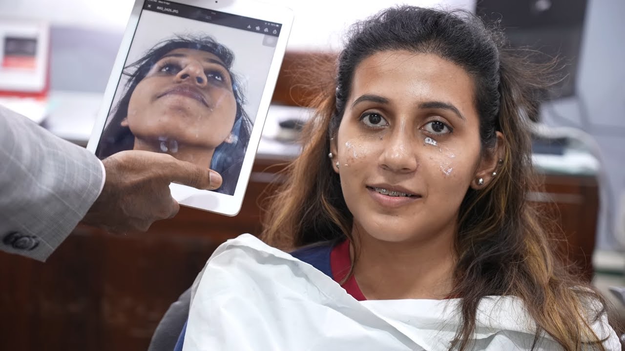 Face Change After Plastic Surgery in India| Jaw Surgery- Before And After Results