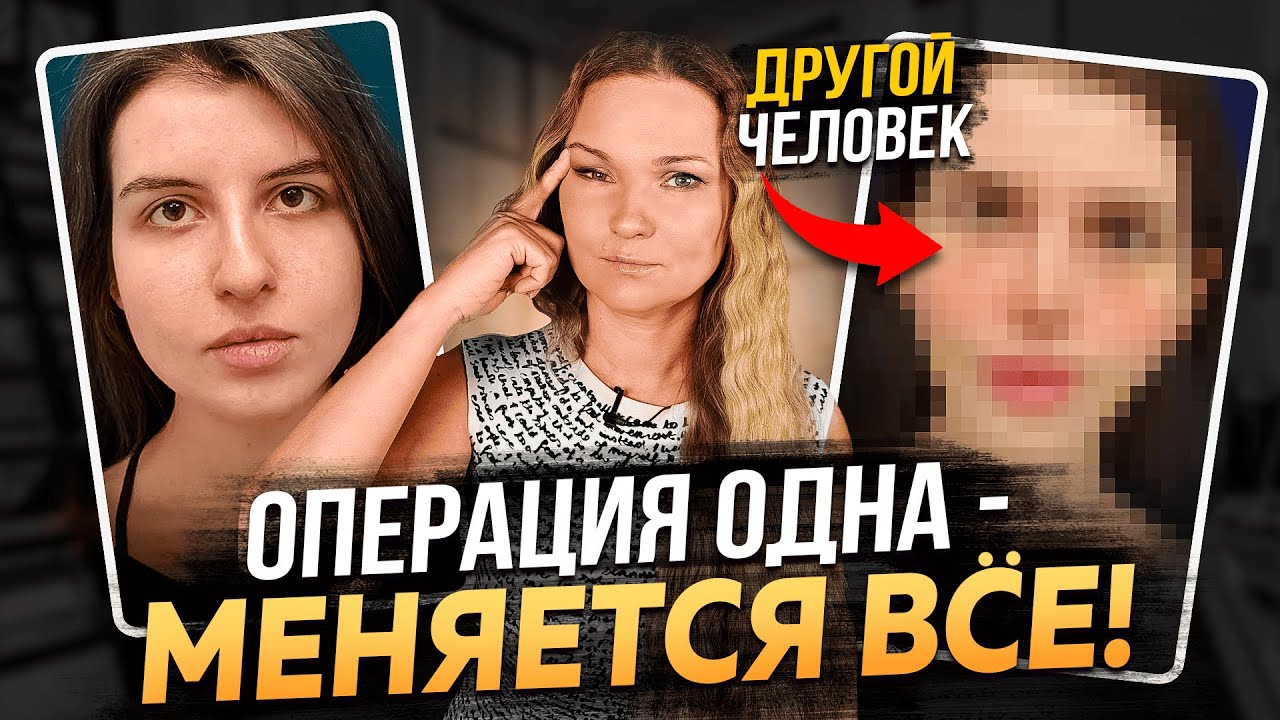 ВЕРХНЯЯ БЛЕФАРОПЛАСТИКА - СМОТРИТЕ ПЕРЕД ТЕМ, КАК ДЕЛАТЬ!