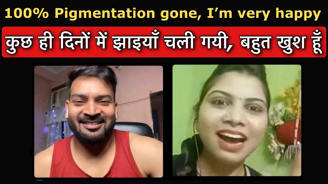 100% Pigmentation gone, I’m very happy. कुछ ही दिनों में झाइयाँ चली गयी, बहुत खुश हूँ