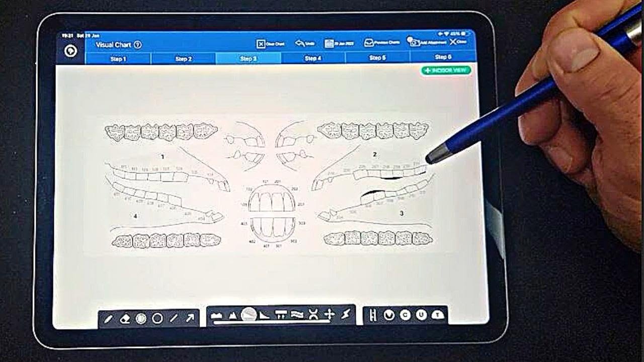 Best equine dental software program
