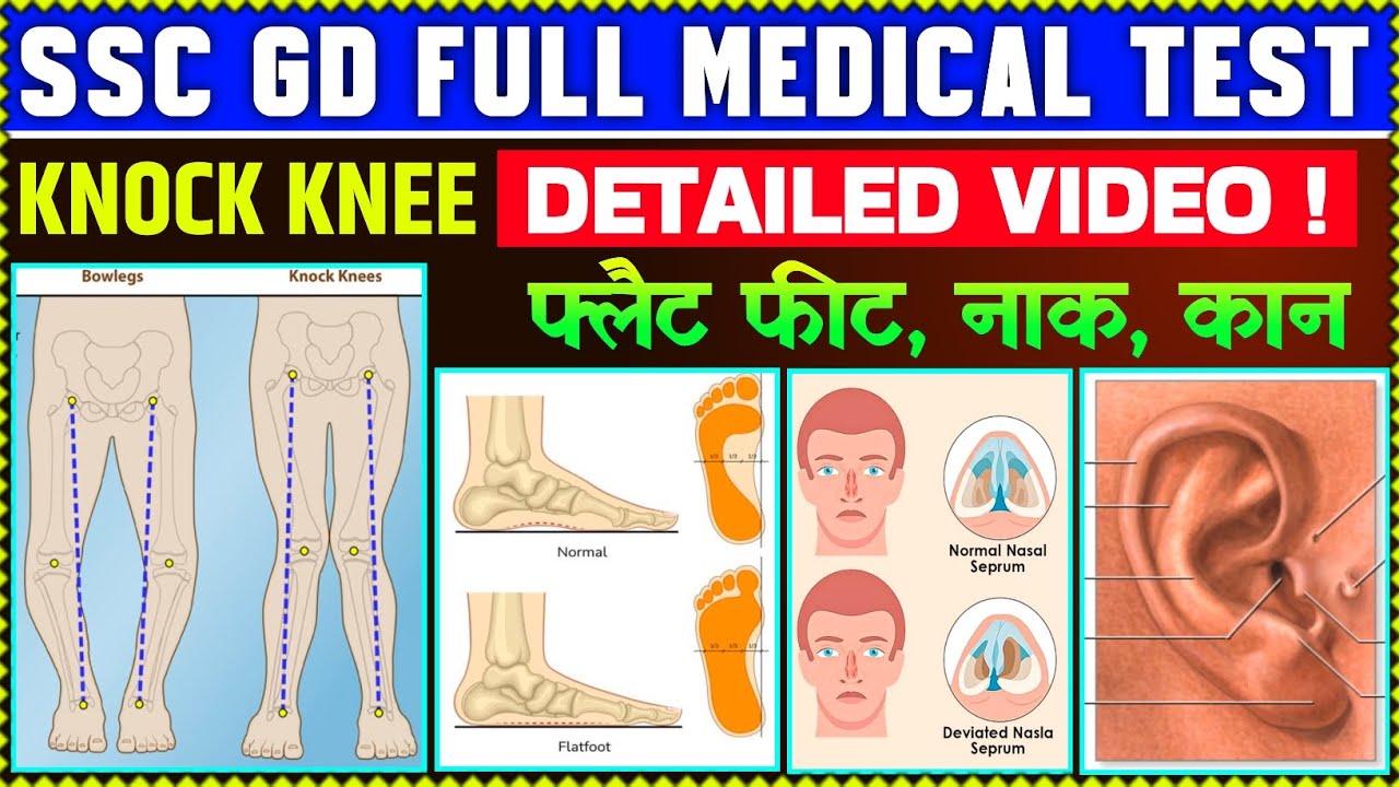 SSC GD DNS 👃 MEDICAL TEST |  FULL MEDICAL TEST DETAILED VIDEO || मेडिकल देने से पहले जरूर देखें !!