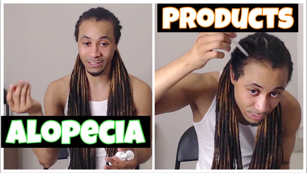 Dreadlock Hair Regrowth Update (Alopecia Update 3) 5 months treatment