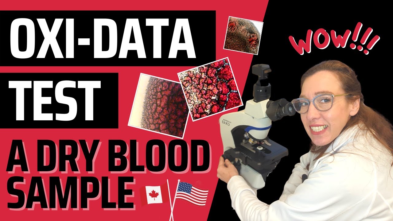 Oxi Data Sample | Revealing a Blood Sample 🔬
