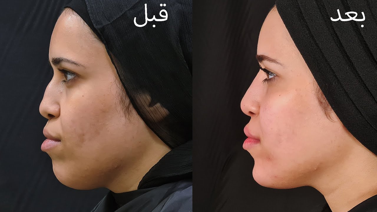في جلسة واحدة Makeover 1