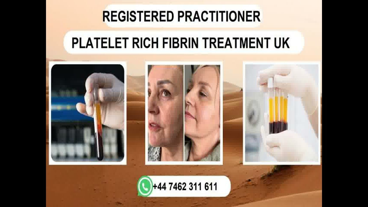 The Best, +44 7462 311 611 Beauty Clinics PRF Treatment UK Sale