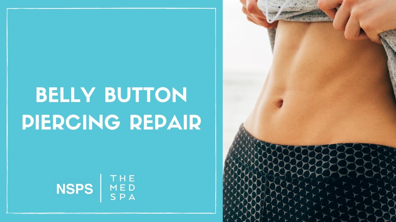 Belly Button Piercing Repair