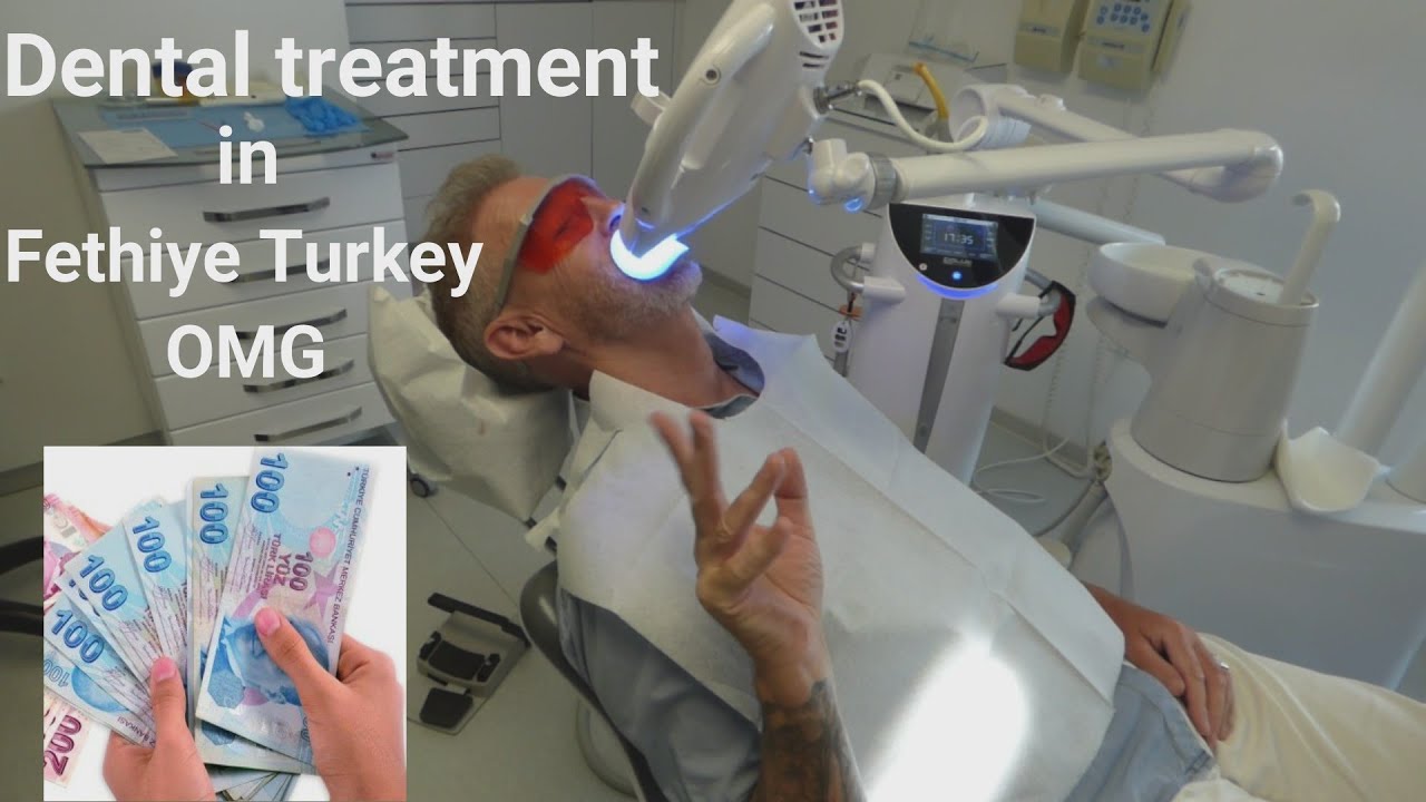Dental treatment in Turkey,  im shocked! So, professional and the cost? wow Have a look at Holident!