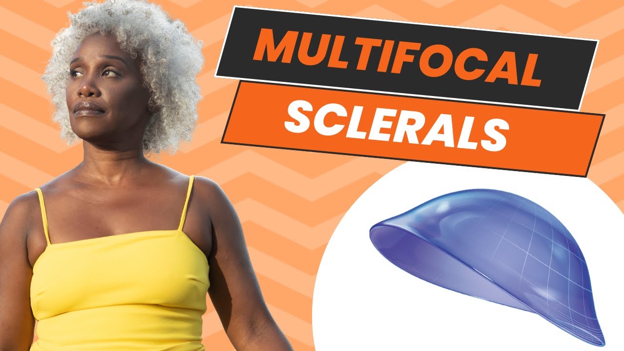 Should I get Multifocal Scleral Lenses? Watch this first!
