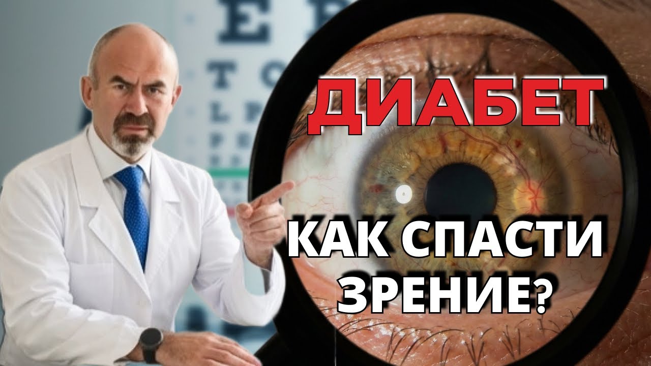 ДИАБЕТИЧЕСКАЯ РЕТИНОПАТИЯ-ЭТО ТИХАЯ СЛЕПОТА! КАК НЕ ПОТЕРЯТЬ ЗРЕНИЕ ПРИ ДИАБЕТЕ 2 ТИПА?