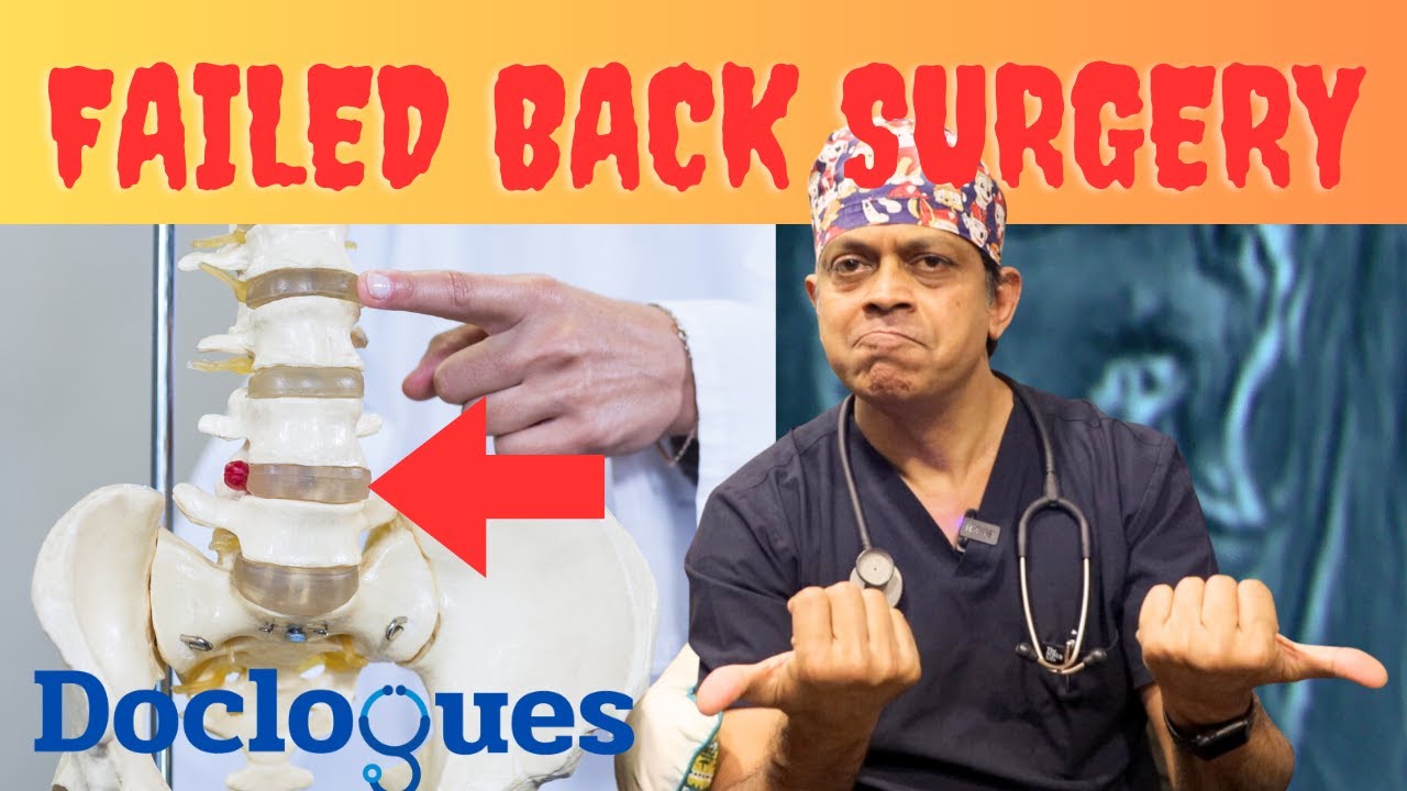 Failed Back Surgery Syndrome
