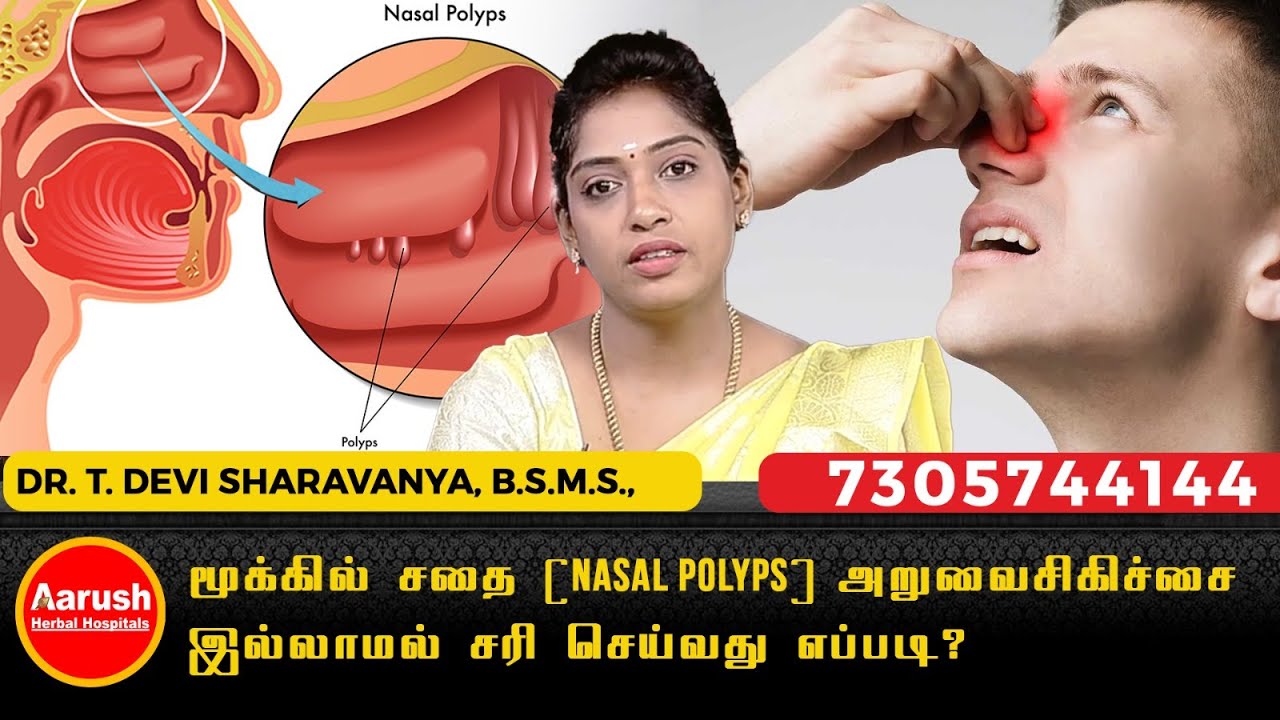 மூக்கில் சதை (Nasal Polyps)-அறுவைசிகிச்சை இல்லாமல் சரிசெய்வது எப்படி? |  Aarush Herbal Hospitals