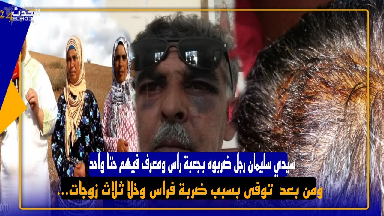 سيدي سليمان رجل ضربوه بجعبة راس ومعرف فيهم حتا واحد  ومن بعد  توفى بسبب ضربة فراس وخلا ثلاث زوجات...