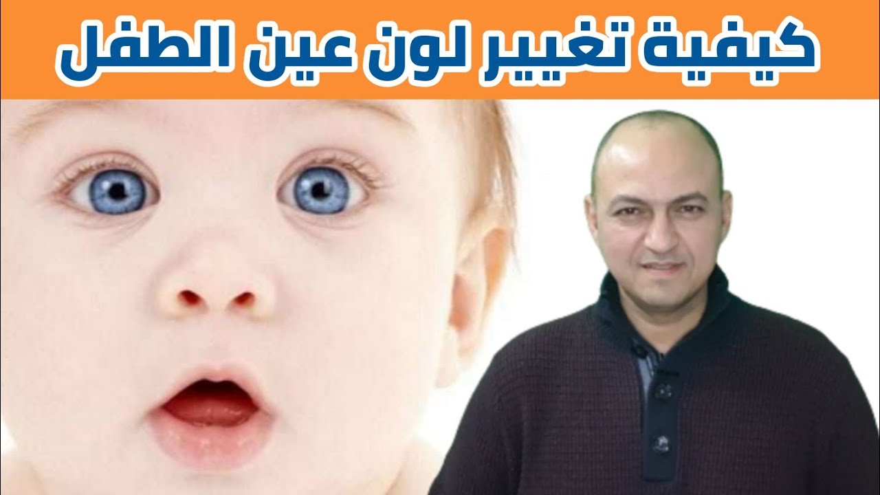 متى يثبت لون عين الطفل و ما هى اسباب تغيير لون عين الطفل - دكتور حاتم فاروق