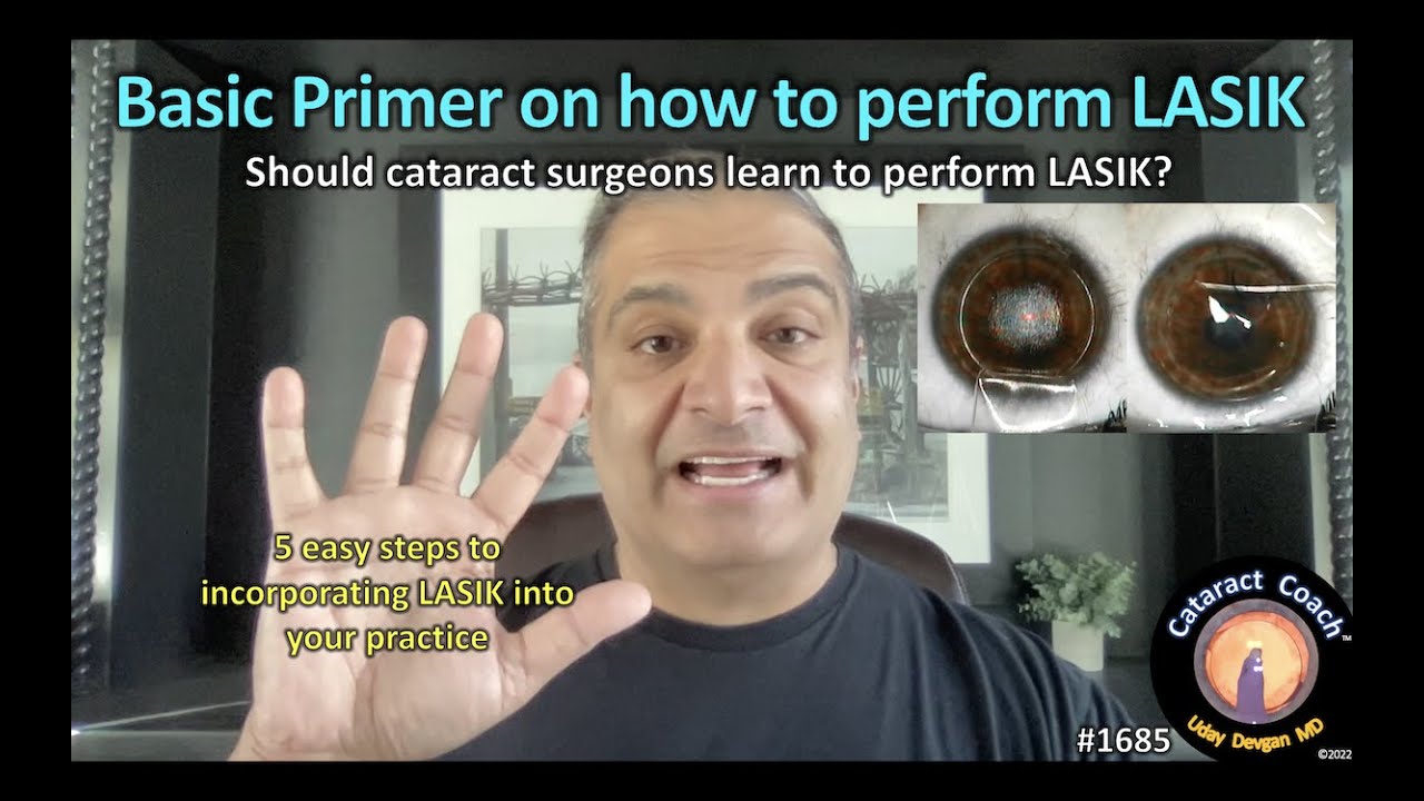 CataractCoach&trade; 1685: basic primer on how to perform LASIK