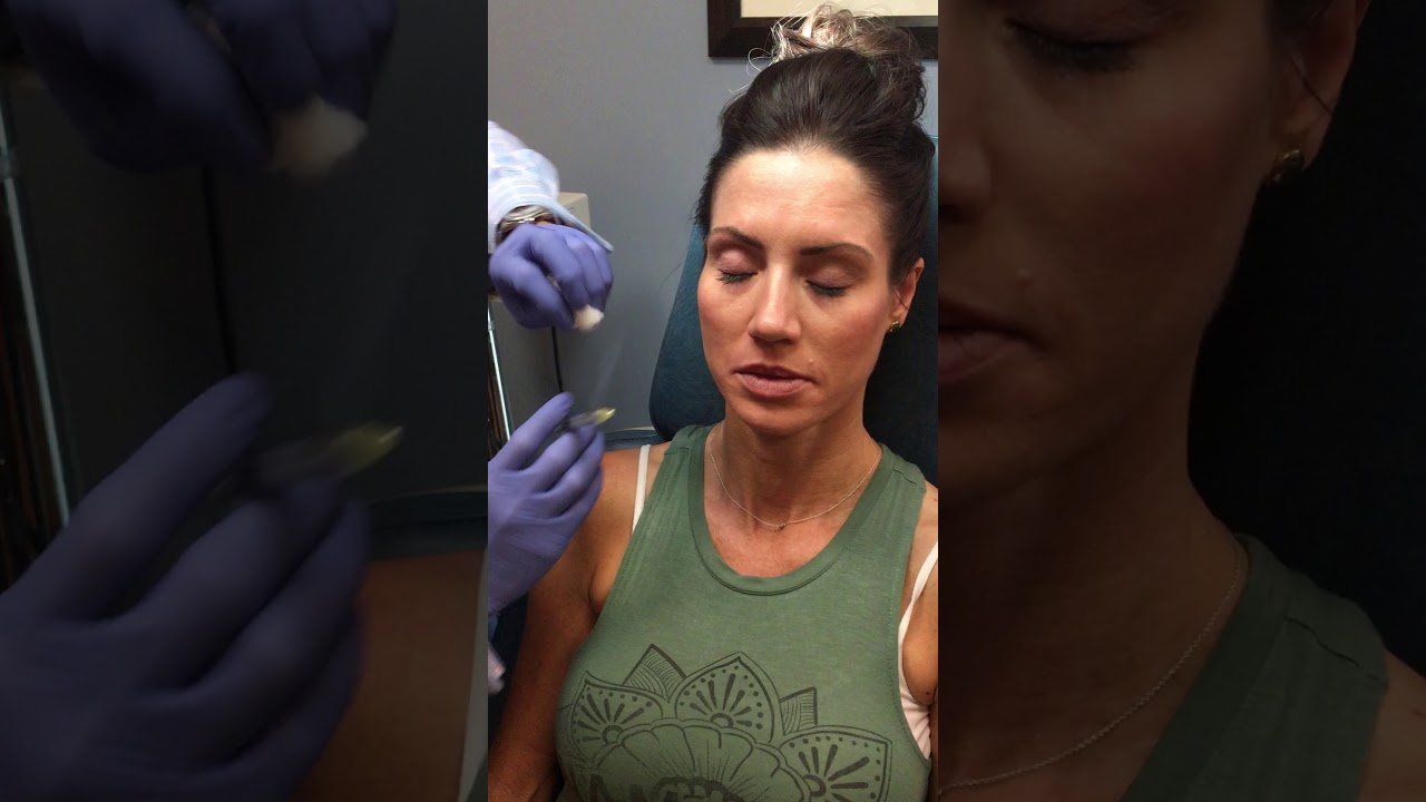 Dr. Raval demonstrates a Volbella injection