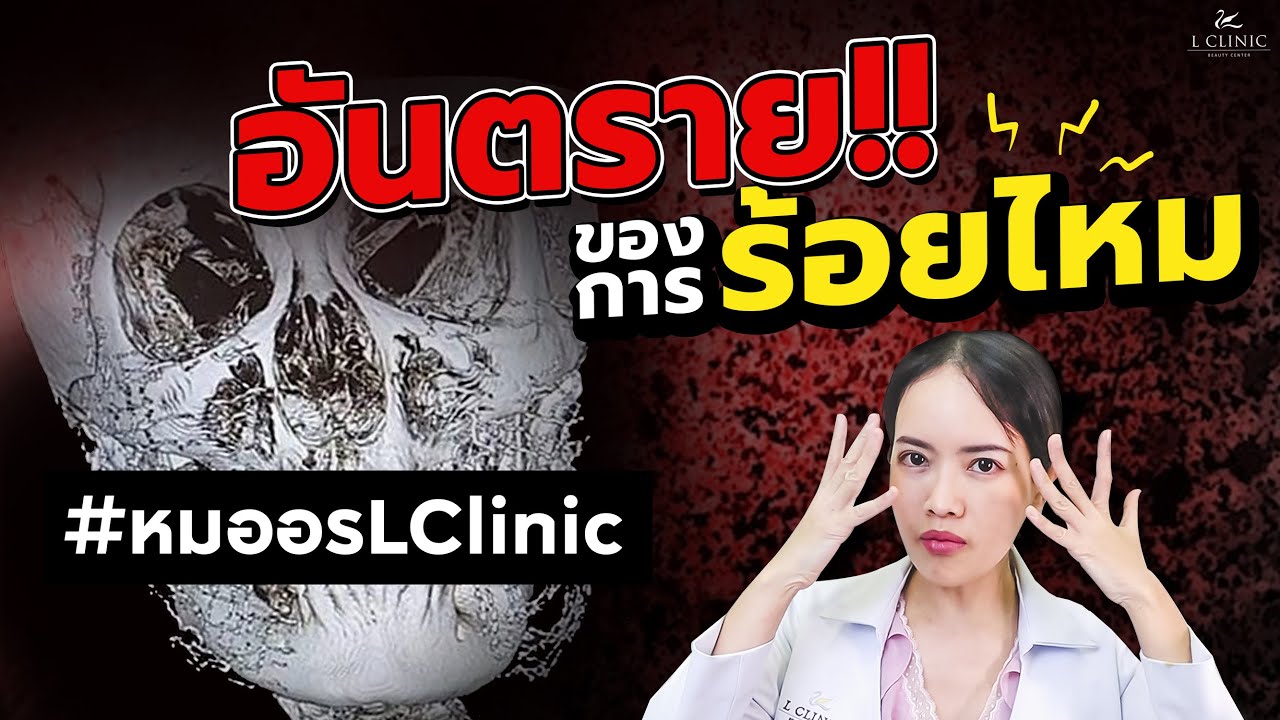 อันตรายของการร้อยไหม !! รีบดูก่อนที่จะสายเกินไป 😮‼️