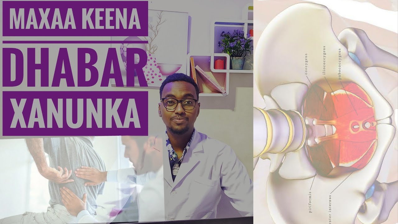 sababaha keena dhabar xanuunka iyo sida lugu daaweyo