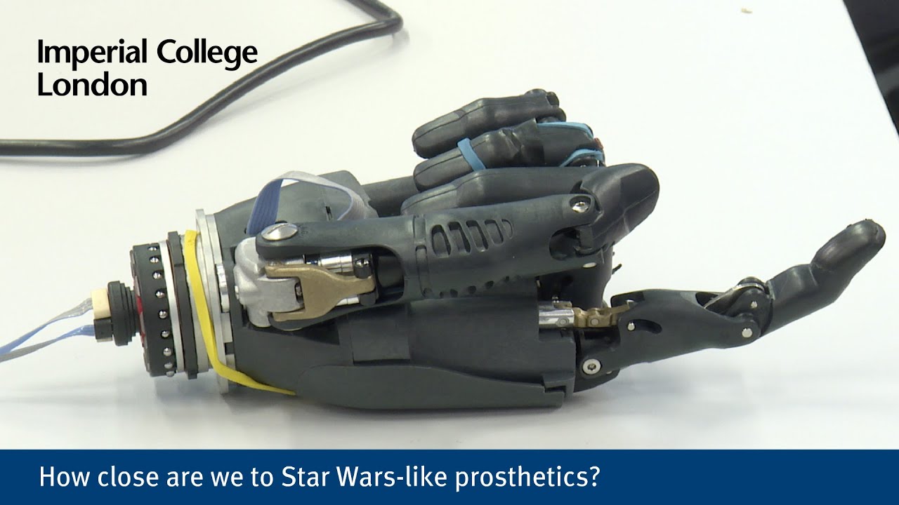 How close are we to Star Wars-like prosthetics?
