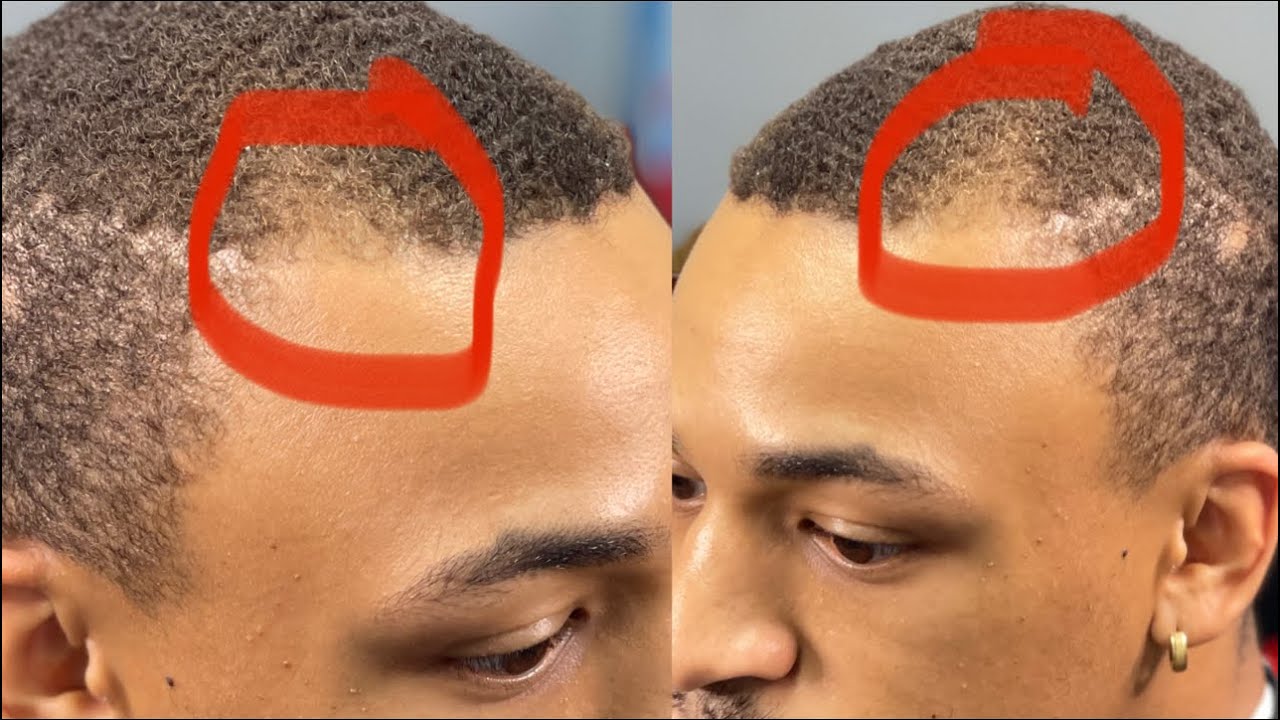 🥴PUSH BACK | CRISPY LINEUP | MID FADE | HAIRLINE CORRECTION