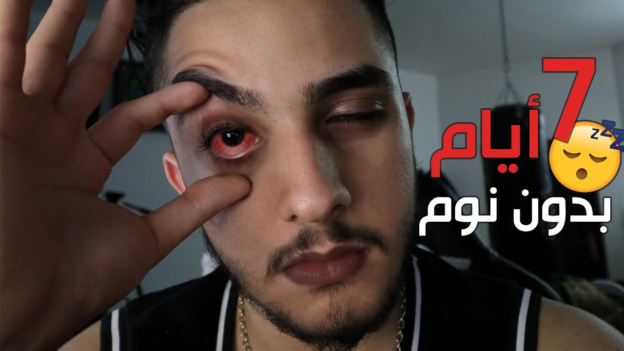 7 ايام بدون نوم! ( شوفو ايش صار!! )