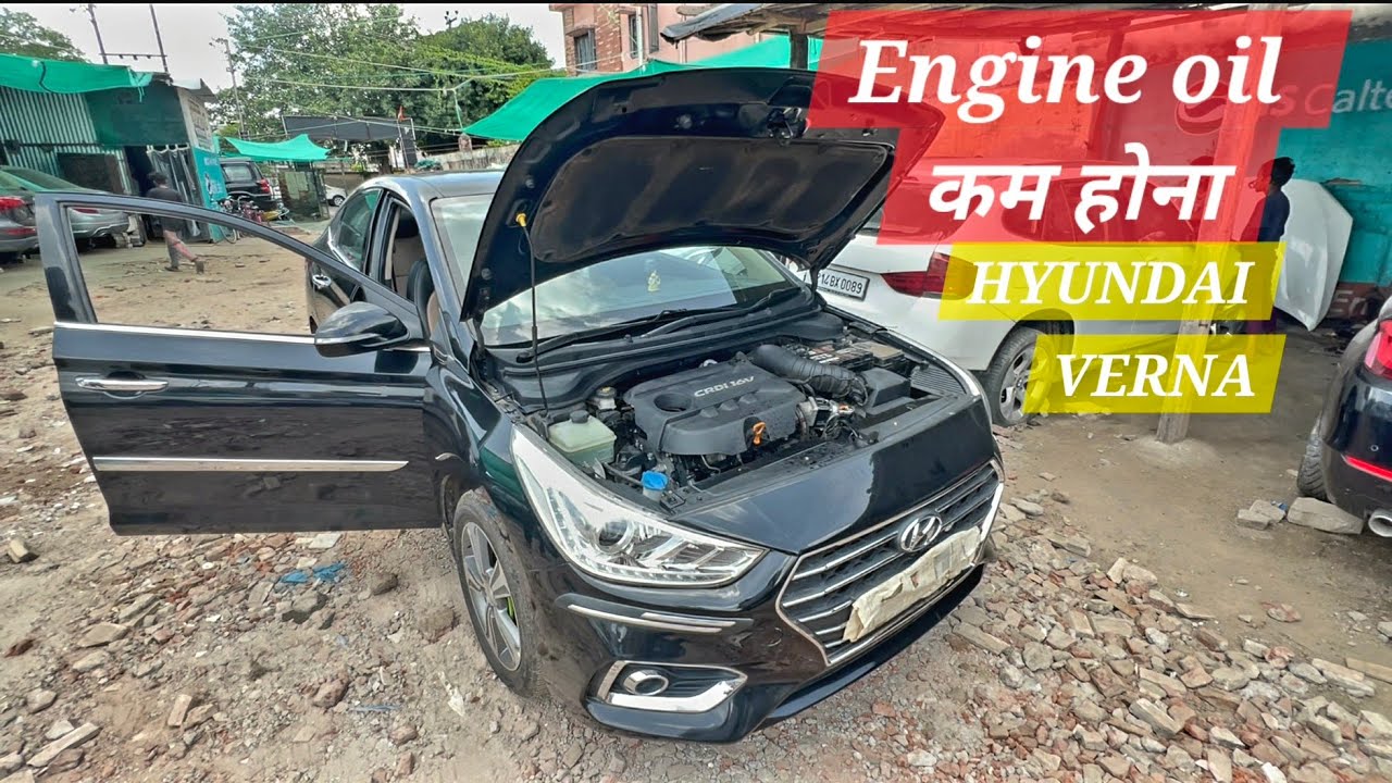 Hyundai Verna Engine Back Compression Problem Solved! 🛠️