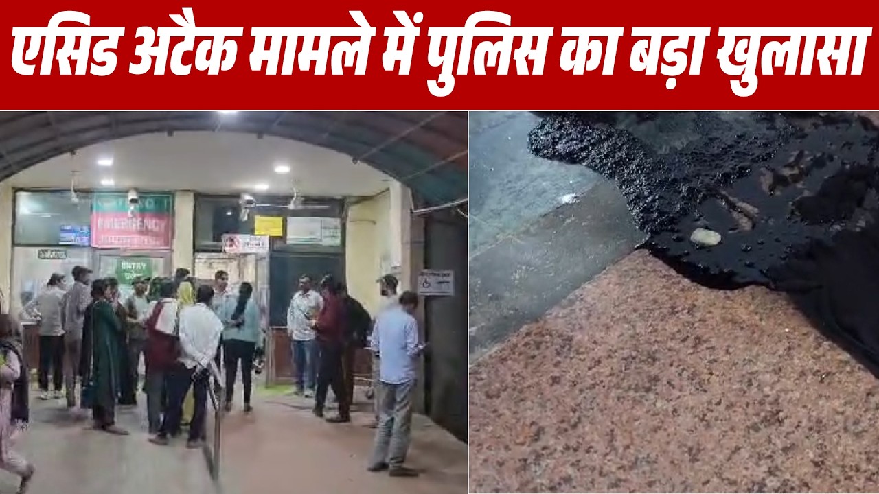 एसिड अटैक मामले में पुलिस का बड़ा खुलासा, गलतफहमी में दूसरी महिला पर फेंका एसिड, आरोपी महिला गिरफ्तार