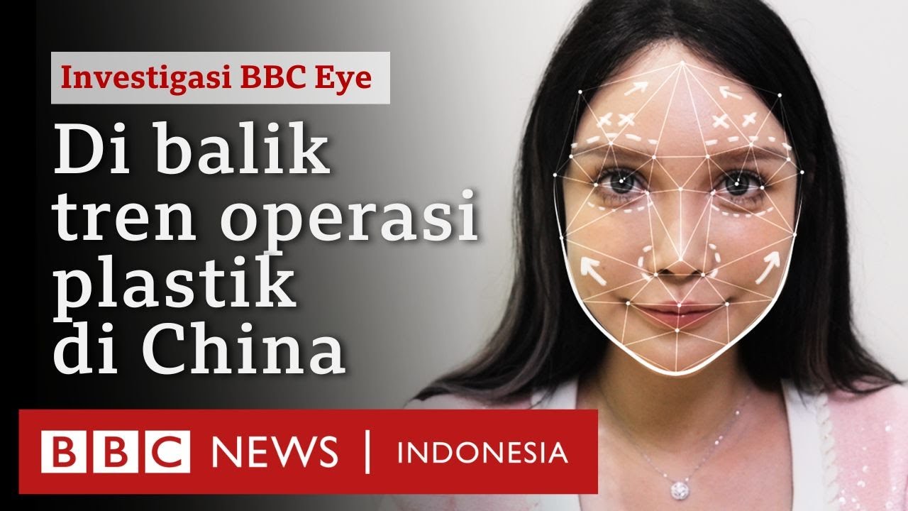 'Saya sudah 100 kali operasi dan tidak akan berhenti' – Di balik tren operasi plastik di China
