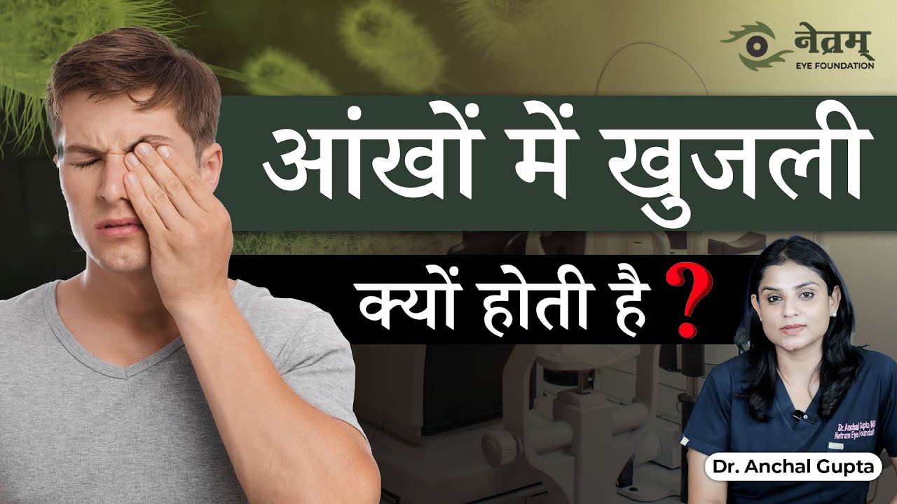 Aankho me Khujli hone ka karan? | Is Itching in Eyes a Dangerous Sign? | Netram Eye Foundation
