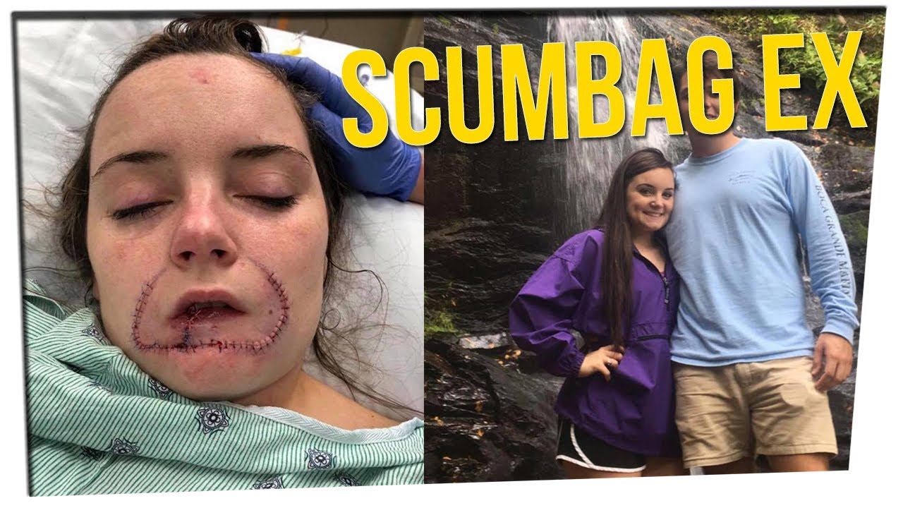 Girl's Lip Bitten Off by Her Ex ft. Boze, Steve Greene & David So