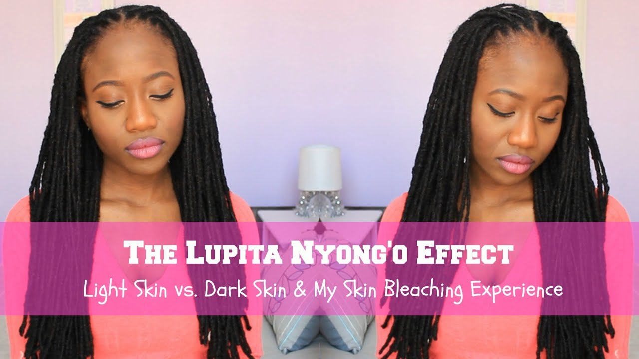 My Skin Bleaching Story...  | JASMINE ROSE