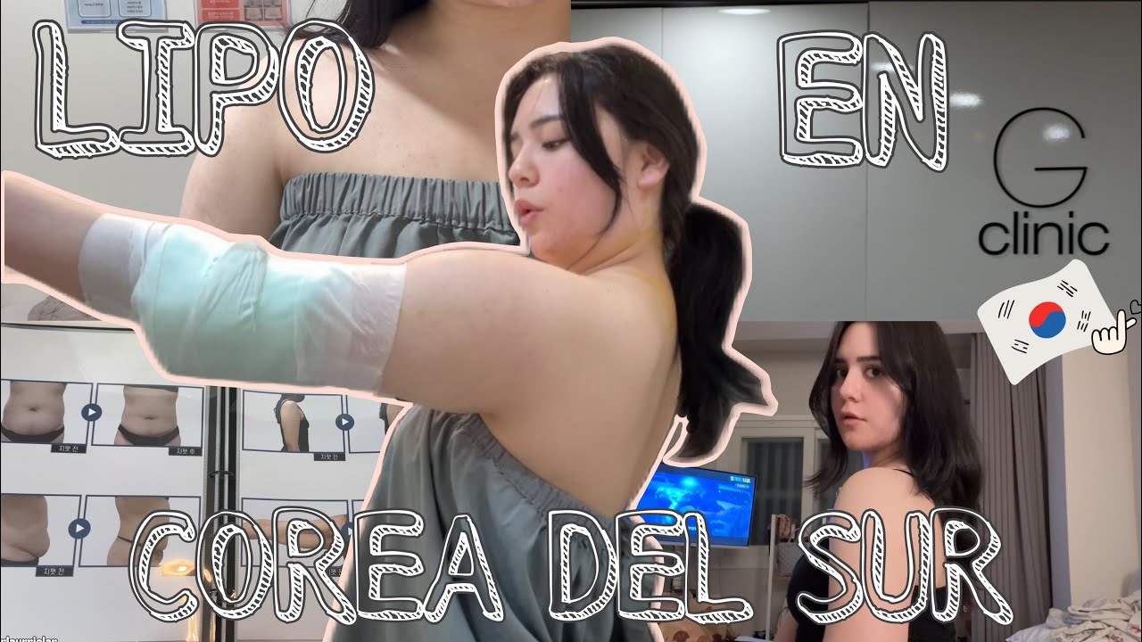 ¡ME HICE UNA LIPO EN COREA DEL SUR!😱🇰🇷 | ¿No quedó como esperaba 😔?