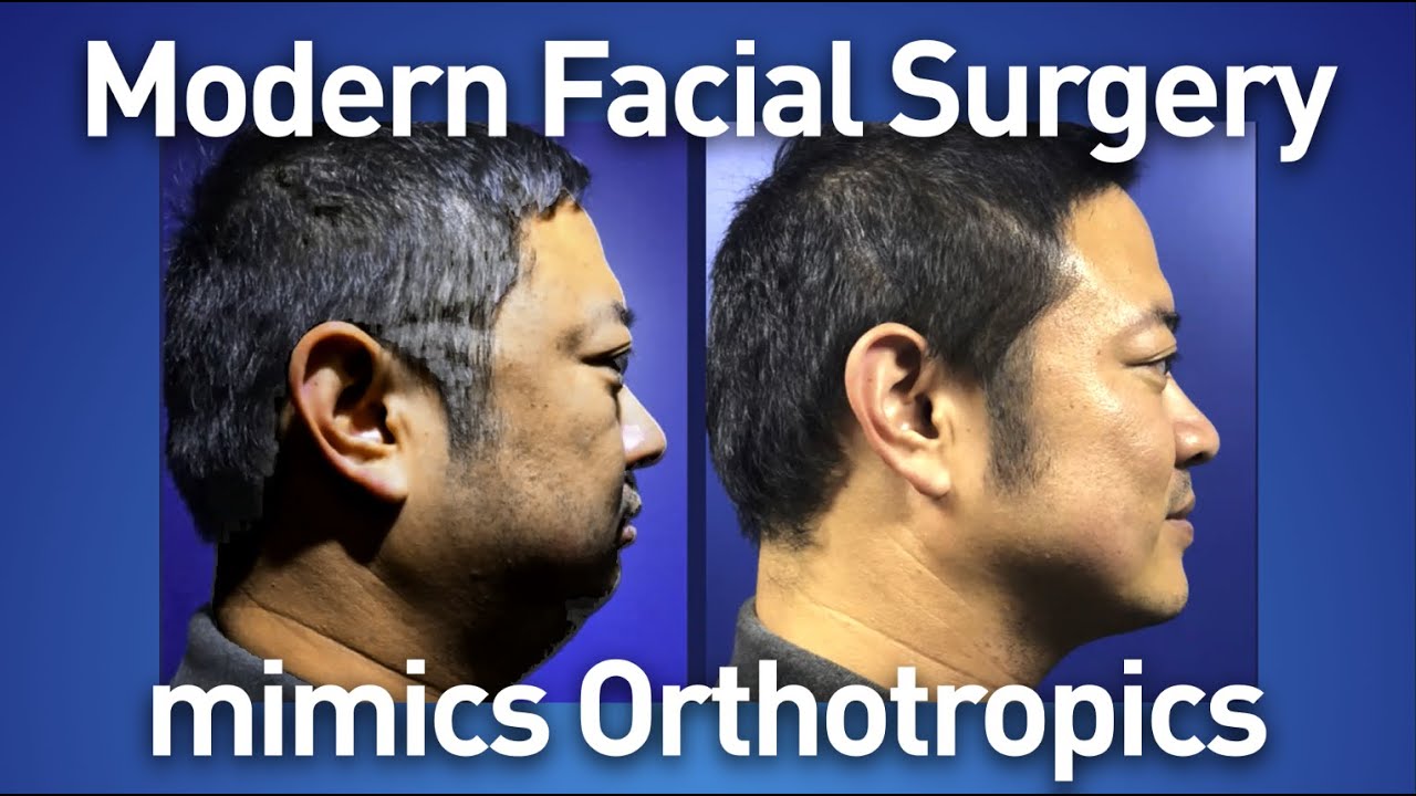 A talk with Simon Wong on surgery