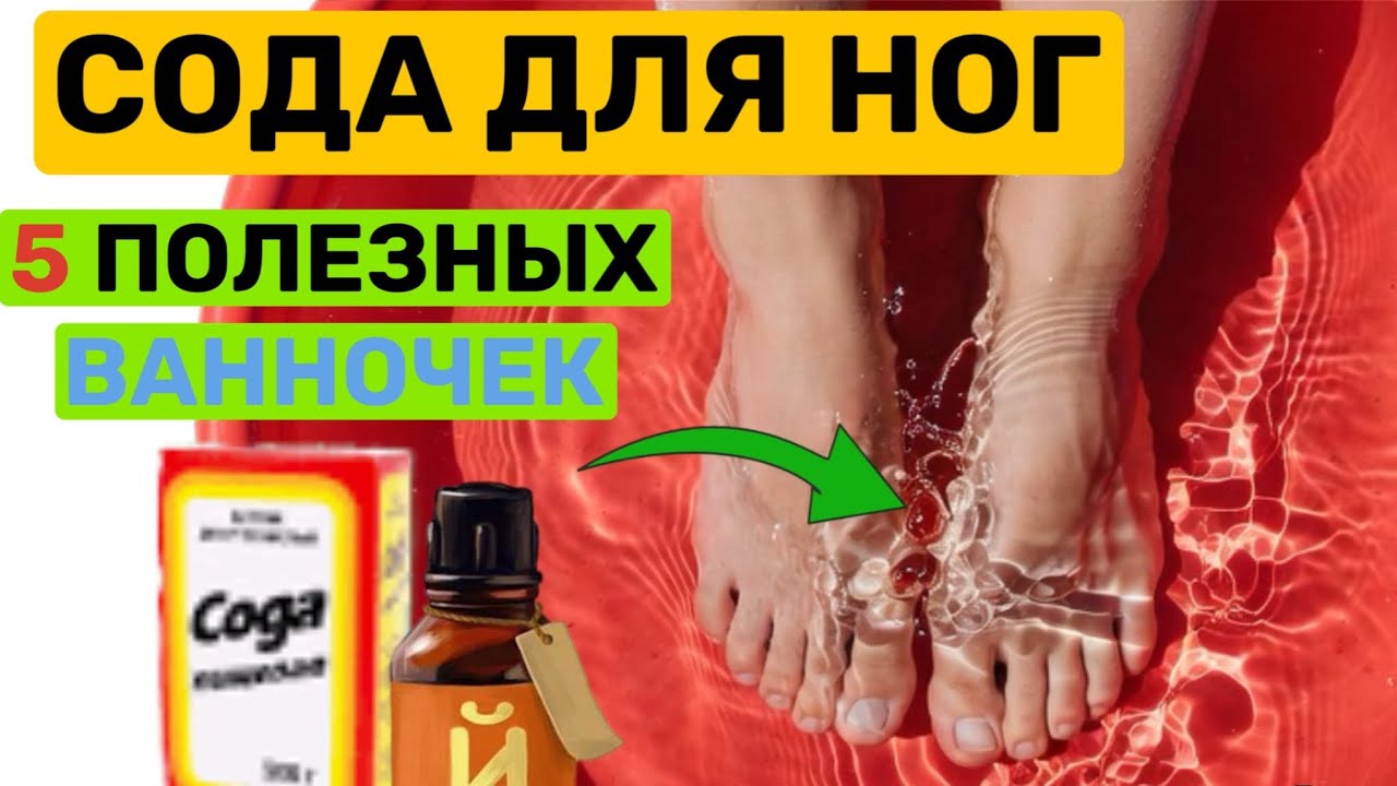 Всего 2 ложки соды и пятки как новые Лучшие ванночки для ног